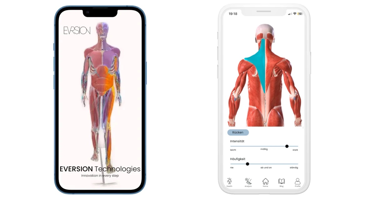 Startbildschirm und geplante Benutzeroberfläche der EVERSION-App für die Sensorsohle.