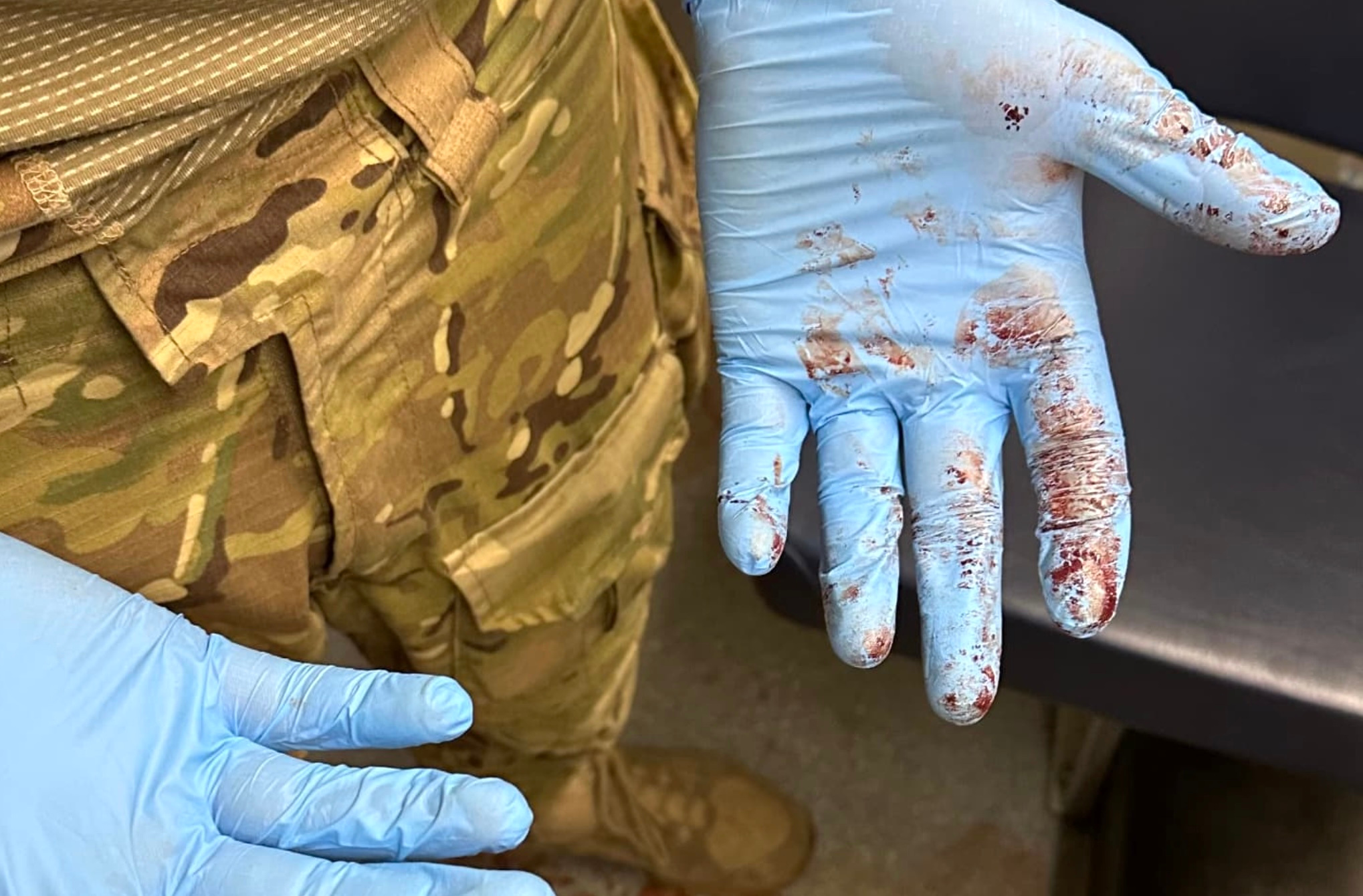 Nicht alles im Ukrainekrieg kann man so einfach abstreifen, wie blutverschmierte Einweghandschuhe.